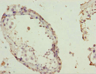 Immunohistochemistry of paraffin-embedded human testis tissue using POC1A Antibody at dilution of 1:100