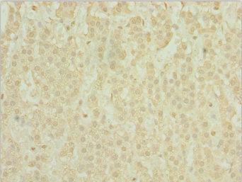Immunohistochemistry of paraffin-embedded human adrenal gland tissue using POC1A Antibody at dilution of 1:100