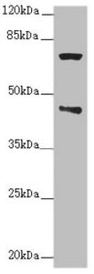Western blot | All lanes: POC1A antibody at 2.76μg/ml + Raji whole cell lysate | Secondary | Goat polyclonal to rabbit IgG at 1/10000 dilution | Predicted band size: 46, 40, 41 kDa | Observed band size: 46, 70 kDa