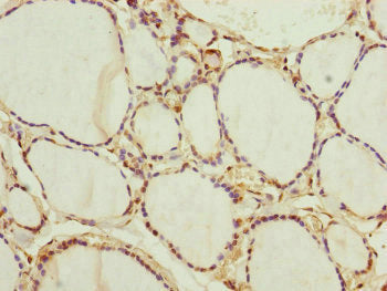 Immunohistochemistry of paraffin-embedded human thyroid tissue using NEDD1 Antibody at dilution of 1:100Rabbit anti-Human NEDD1 Polyclonal Antibody