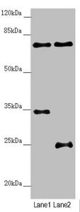 Western blot | All lanes: NEDD1 antibody at 3.25μg/ml | Lane 1: Mouse small intestine tissue | Lane 2: Jurkat whole cell lysate | Secondary | Goat polyclonal to rabbit IgG at 1/10000 dilution | Predicted band size: 72, 63, 73 kDa | Observed band size: 72 kDaRabbit anti-Human NEDD1 Polyclonal Antibody