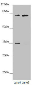 Western blot | All lanes: NEDD1 antibody at 2.66μg/ml | Lane 1: Mouse brain tissue | Lane 2: Jurkat whole cell lysate | Secondary | Goat polyclonal to rabbit IgG at 1/10000 dilution | Predicted band size: 72, 63, 73 kDa | Observed band size: 72 kDaRabbit anti-Human NEDD1 Polyclonal Antibody