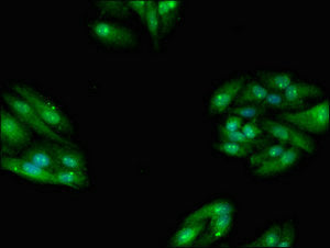 Immunofluorescent analysis of HepG2 cells using TBC1D15 Antibody at dilution of 1:100 and Alexa Fluor 488-congugated AffiniPure Goat Anti-Rabbit IgG(H+L)Rabbit anti-Human TBC1D15 Polyclonal Antibody