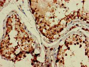 Immunohistochemistry of paraffin-embedded human testis tissue using TBC1D15 Antibody at dilution of 1:100Rabbit anti-Human TBC1D15 Polyclonal Antibody