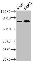 Western Blot  | Positive WB detected in: A549 whole cell lysate, HepG2 whole cell lysate  | All lanes: TBC1D15 antibody at 3µg/ml  | Secondary  | Goat polyclonal to rabbit IgG at 1/50000 dilution  | Predicted band size: 80, 78, 79 kDa  | Observed band size: 80 kDaRabbit anti-Human TBC1D15 Polyclonal Antibody