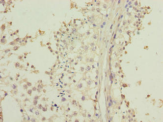 Immunohistochemistry of paraffin-embedded human testis tissue using LRRC20 Antibody at dilution of 1:100