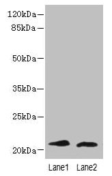 Western blot  | All lanes: LRRC20 antibody at 1µg/ml  | Lane 1: Jurkat whole cell lysate  | Lane 2: Mouse spleen tissue  | Secondary  | Goat polyclonal to rabbit IgG at 1/10000 dilution  | Predicted band size: 21, 15 kDa  | Observed band size: 21 kDa