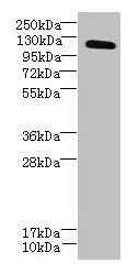 Western blot  | All lanes: DIS3L antibody at 6µg/ml + MCF-7 whole cell lysate  | Secondary  | Goat polyclonal to rabbit IgG at 1/10000 dilution  | Predicted band size: 121, 106, 87, 112 kDa  | Observed band size: 121 kDaRabbit anti-Human DIS3L Polyclonal Antibody