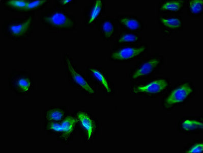 Immunofluorescence staining of A549 cells with SLC22A17 Antibody at 1:66, counter-stained with DAPI. The cells were fixed in 4% formaldehyde, permeabilized using 0.2% Triton X-100 and blocked in 10% normal Goat Serum. The cells were then incubated with the antibody overnight at 4°C. The secondary antibody was Alexa Fluor 488-congugated AffiniPure Goat Anti-Rabbit IgG(H+L).Rabbit anti-Human SLC22A17 Polyclonal Antibody