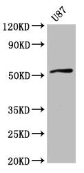 Western Blot  | Positive WB detected in: U87 whole cell lysate  | All lanes: SLC22A17 antibody at 4µg/ml  | Secondary  | Goat polyclonal to rabbit IgG at 1/50000 dilution  | Predicted band size: 58, 56, 22 kDa  | Observed band size: 58 kDaRabbit anti-Human SLC22A17 Polyclonal Antibody