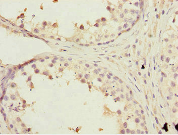 Immunohistochemistry of paraffin-embedded human testis tissue using KBTBD7 Antibody at dilution of 1:100