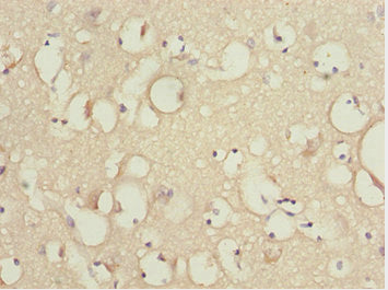 Immunohistochemistry of paraffin-embedded human brain tissue using KBTBD7 Antibody at dilution of 1:100