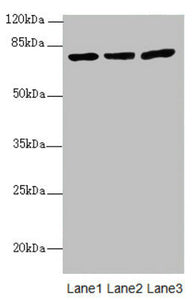 Western blot | All lanes: KBTBD7 antibody at 1.85μg/ml | Lane 1: HL60 whole cell lysate | Lane 2: A549 whole cell lysate | Lane 3: 293T whole cell lysate | Secondary | Goat polyclonal to rabbit IgG at 1/10000 dilution | Predicted band size: 77 kDa | Observed band size: 77 kDa