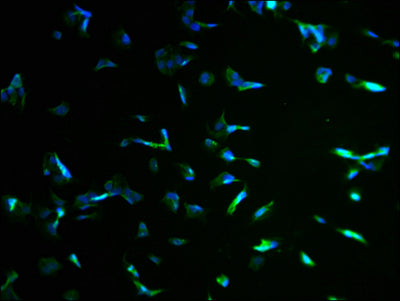 Immunofluorescence staining of MCF-7 cells with KBTBD7 Antibody at 1:100, counter-stained with DAPI. The cells were fixed in 4% formaldehyde and blocked in 10% normal Goat Serum. The cells were then incubated with the antibody overnight at 4°C. The secondary antibody was Alexa Fluor 488-congugated AffiniPure Goat Anti-Rabbit IgG(H+L).