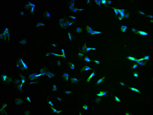 Immunofluorescence staining of MCF-7 cells with KBTBD7 Antibody at 1:100, counter-stained with DAPI. The cells were fixed in 4% formaldehyde and blocked in 10% normal Goat Serum. The cells were then incubated with the antibody overnight at 4°C. The secondary antibody was Alexa Fluor 488-congugated AffiniPure Goat Anti-Rabbit IgG(H+L).