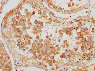 IHC image of the antibody diluted at 1:200 and staining in paraffin-embedded human testis tissue performed on a Leica BondTM system. After dewaxing and hydration, antigen retrieval was mediated by high pressure in a citrate buffer (pH 6.0). Section was blocked with 10% normal goat serum 30min at RT. Then primary antibody (1% BSA) was incubated at 4°C overnight. The primary is detected by a Goat anti-rabbit polymer IgG labeled by HRP and visualized using 0.05% DAB.