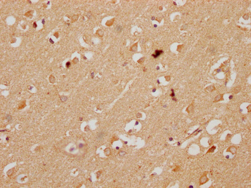 IHC image of KBTBD7 Antibody diluted at 1:200 and staining in paraffin-embedded human brain tissue performed on a Leica BondTM system. After dewaxing and hydration, antigen retrieval was mediated by high pressure in a citrate buffer (pH 6.0). Section was blocked with 10% normal goat serum 30min at RT. Then primary antibody (1% BSA) was incubated at 4°C overnight. The primary is detected by a Goat anti-rabbit polymer IgG labeled by HRP and visualized using 0.05% DAB.