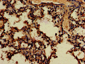 Immunohistochemistry of paraffin-embedded human lung tissue using the antibody at dilution of 1:100Rabbit anti-Human APOBEC4 Polyclonal Antibody