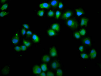 Immunofluorescence staining of Hela cells with LMO7 Antibody at 1:66, counter-stained with DAPI. The cells were fixed in 4% formaldehyde, permeabilized using 0.2% Triton X-100 and blocked in 10% normal Goat Serum. The cells were then incubated with the antibody overnight at 4°C. The secondary antibody was Alexa Fluor 488-congugated AffiniPure Goat Anti-Rabbit IgG(H+L).Rabbit anti-Human LMO7 Polyclonal Antibody