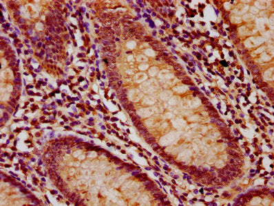 IHC image of the antibody diluted at 1:200 and staining in paraffin-embedded human appendix tissue performed on a Leica BondTM system. After dewaxing and hydration, antigen retrieval was mediated by high pressure in a citrate buffer (pH 6.0). Section was blocked with 10% normal goat serum 30min at RT. Then primary antibody (1% BSA) was incubated at 4°C overnight. The primary is detected by a biotinylated secondary antibody and visualized using an HRP conjugated SP system.