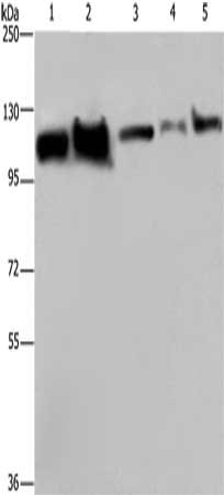 Gel: 6%SDS-PAGE, Lysate: 40 μg, Lane 1-5: Hela cells, Raji cells, NIH/3T3 cells, HepG2 cells, A375 cells, Primary antibody: HSPA4 Antibody(HSPA4 Antibody) at dilution 1/300, Secondary antibody: Goat anti rabbit IgG at 1/8000 dilution, Exposure time: 40 secondsRabbit anti-Human HSPA4 Polyclonal Antibody