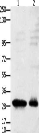 Gel: 10%SDS-PAGE, Lysate: 40 μg, Lane 1-2: 231 cells, mouse testis tissue, Primary antibody: GNRHR Antibody(GNRHR Antibody) at dilution 1/2350, Secondary antibody: Goat anti rabbit IgG at 1/8000 dilution, Exposure time: 25 secondsRabbit anti-Human GNRHR Polyclonal Antibody