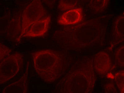 Immunofluorescence staining of methanol-fixed MCF7 cells using Her3/ErbB3(phospho-Tyr1328) Antibody.Rabbit anti-Human ERBB3 Polyclonal Antibody
