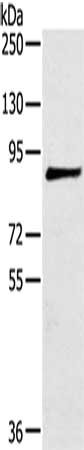 Gel: 6%SDS-PAGE, Lysate: 40 μg, Lane: 293T cells, Primary antibody: MAGEE1 Antibody(MAGEE1 Antibody) at dilution 1/200, Secondary antibody: Goat anti rabbit IgG at 1/8000 dilution, Exposure time: 5 minutesRabbit anti-Human MAGEE1 Polyclonal Antibody