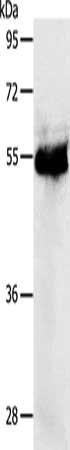 Gel: 10%SDS-PAGE, Lysate: 40 μg, Lane: Human colon cancer tissue, Primary antibody: PRKAR1B Antibody(PRKAR1B Antibody) at dilution 1/1200, Secondary antibody: Goat anti rabbit IgG at 1/8000 dilution, Exposure time: 20 secondsRabbit anti-Human PRKAR1B Polyclonal Antibody