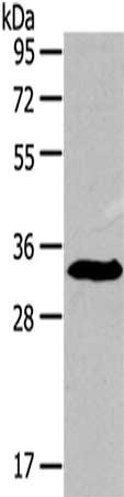 Gel: 8%SDS-PAGE,Lysate: 40 μg,,Primary antibody: IGFBP3 Antibody(IGFBP3 Antibody) at dilution 1/300 dilution,Secondary antibody: Goat anti rabbit IgG at 1/8000 dilution,Exposure time: 1 minute