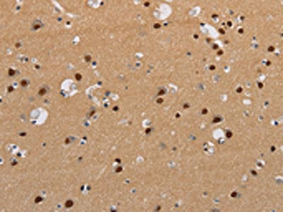 The image on the left is immunohistochemistry of paraffin-embedded Human brain  tissue using KCNG4 Antibody(KCNG4 Antibody) at dilution 1/40, on the right is treated with synthetic peptide. (Original magnification: ×200)
