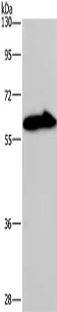 Gel: 6%SDS-PAGE, Lysate: 40 μg, Lane: Mouse brain tissue, Primary antibody: KCNG4 Antibody(KCNG4 Antibody) at dilution 1/550, Secondary antibody: Goat anti rabbit IgG at 1/8000 dilution, Exposure time: 2 minutes