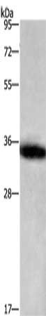 Gel: 10%SDS-PAGE, Lysate: 40 μg, Lane: Mouse testis tissue, Primary antibody: IL1B Antibody(IL1B Antibody) at dilution 1/100, Secondary antibody: Goat anti rabbit IgG at 1/8000 dilution, Exposure time: 1 second