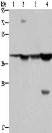 Gel: 8%SDS-PAGE, Lysate: 40 μg, Lane 1-4: Mouse stomach tissue, human fetal liver tissue, MCF7 cells, mouse liver tissue tissue, Primary antibody: FBP1 Antibody(FBP1 Antibody) at dilution 1/850, Secondary antibody: Goat anti rabbit IgG at 1/8000 dilution, Exposure time: 10 secondsRabbit anti-Human FBP1 Polyclonal Antibody