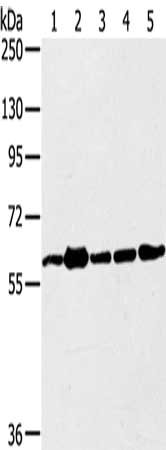 Gel: 6%SDS-PAGE, Lysate: 40 μg, Lane 1-5: 231 cells, Jurkat cells, A549 cells, hela cells, 293T cells, Primary antibody: TRIM45 Antibody(TRIM45 Antibody) at dilution 1/400, Secondary antibody: Goat anti rabbit IgG at 1/8000 dilution, Exposure time: 1 minuteRabbit anti-Human TRIM45 Polyclonal Antibody