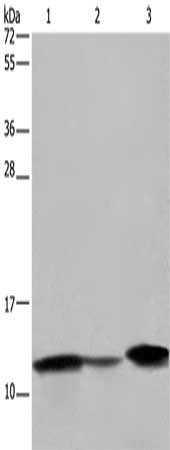 Gel: 10%SDS-PAGE, Lysate: 40 μg, Lane 1-3: Human fetal intestine tissue, mouse colon tissue, Mouse large intestine tissue, Primary antibody: FABP2 Antibody(FABP2 Antibody) at dilution 1/450, Secondary antibody: Goat anti rabbit IgG at 1/8000 dilution, Exposure time: 30 secondsRabbit anti-Human FABP2 Polyclonal Antibody