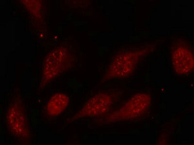 Immunofluorescence staining of methanol-fixed Hela cells using p53(Phospho-Ser315) Antibody.Rabbit anti-Human TP53 Polyclonal Antibody
