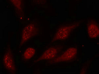 Immunofluorescence staining of methanol-fixed Hela cells using p53(Phospho-Ser315) Antibody.Rabbit anti-Human TP53 Polyclonal Antibody