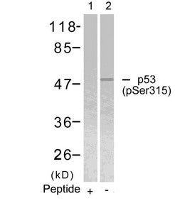 Western blot analysis of extracts from Hela cells using p53(Phospho-Ser315) Antibody(Lane 2) and the same antibody preincubated with blocking peptide(Lane1).Rabbit anti-Human TP53 Polyclonal Antibody