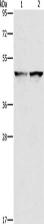 Gel: 8%SDS-PAGE, Lysate: 40 μg, Lane 1-2: 231 cells, hela cells, Primary antibody: IDH1 Antibody(IDH1 Antibody) at dilution 1/550, Secondary antibody: Goat anti rabbit IgG at 1/8000 dilution, Exposure time: 20 secondsRabbit anti-Human IDH1 Polyclonal Antibody