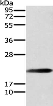 Gel: 12%SDS-PAGE, Lysate: 40 μg, Lane: Mouse brain tissue, Primary antibody: RAP1A Antibody(RAP1A Antibody) at dilution 1/200 dilution, Secondary antibody: Goat anti rabbit IgG at 1/8000 dilution, Exposure time: 10 secondsRabbit anti-Human RAP1A Polyclonal Antibody