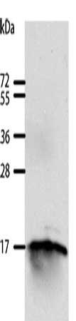 Gel: 12%SDS-PAGE, Lysate: 40 μg, Lane: 293T cells, Primary antibody: GIP Antibody(GIP Antibody) at dilution 1/250, Secondary antibody: Goat anti rabbit IgG at 1/8000 dilution, Exposure time: 10 minutesRabbit anti-Human GIP Polyclonal Antibody