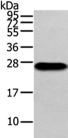 Gel: 12%SDS-PAGE, Lysate: 40 μg, Lane: Human plasma solution, Primary antibody: IGLV1-51 Antibody(Lambda Light chain Antibody) at dilution 1/200 dilution, Secondary antibody: Goat anti rabbit IgG at 1/8000 dilution, Exposure time: 10 secondsRabbit anti-Human IGLV1-51 Polyclonal Antibody