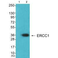 Western blot analysis of extracts from Hela cells (Lane 2), using ERCC1 antiobdy. The lane on the left is treated with synthesized peptide.Rabbit anti-Human ERCC1 Polyclonal Antibody