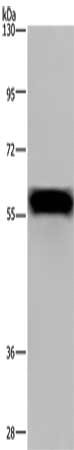 Gel: 6%SDS-PAGE, Lysate: 40 μg, Lane: Mouse heart tissue, Primary antibody: FGB Antibody(FGB Antibody) at dilution 1/1000, Secondary antibody: Goat anti rabbit IgG at 1/8000 dilution, Exposure time: 5 secondsRabbit anti-Human FGB Polyclonal Antibody