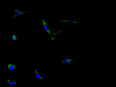 Immunofluorescence staining of MCF-7 cell with ABCA3 Antibody at 1:30, counter-stained with DAPI. The cells were fixed in 4% formaldehyde and blocked in 10% normal Goat Serum. The cells were then incubated with the antibody overnight at 4C. The secondary antibody was Alexa Fluor 488-congugated AffiniPure Goat Anti-Rabbit IgG(H+L).
