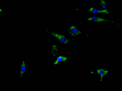 Immunofluorescence staining of SH-SY5Y cell with ABCA3 Antibody at 1:30, counter-stained with DAPI. The cells were fixed in 4% formaldehyde and blocked in 10% normal Goat Serum. The cells were then incubated with the antibody overnight at 4C. The secondary antibody was Alexa Fluor 488-congugated AffiniPure Goat Anti-Rabbit IgG(H+L).