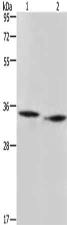 Gel: 10%SDS-PAGE, Lysate: 40 μg, Lane 1-2: mouse heart tissue, Mouse liver tissue, Primary antibody: AMDHD2 Antibody(AMDHD2 Antibody) at dilution 1/500, Secondary antibody: Goat anti rabbit IgG at 1/8000 dilution, Exposure time: 3 minutesRabbit anti-Human AMDHD2 Polyclonal Antibody