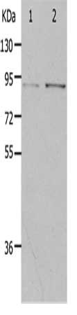 Gel: 10%SDS-PAGE, Lysate: 40 μg, Lane 1-2: Hela cells, 293T cells, Primary antibody: PIBF1 Antibody(PIBF1 Antibody) at dilution 1/400, Secondary antibody: Goat anti rabbit IgG at 1/8000 dilution, Exposure time: 2 minutesRabbit anti-Human PIBF1 Polyclonal Antibody