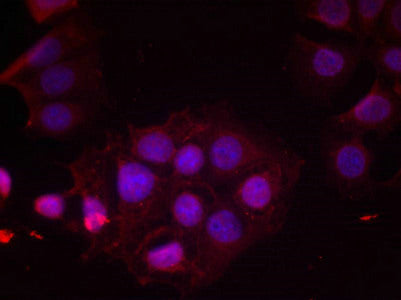 Immunofluorescence staining of methanol-fixed MCF cells using Estrogen Receptor-a(Phospho-Ser118) Antibody.Rabbit anti-Human ESR1 Polyclonal Antibody